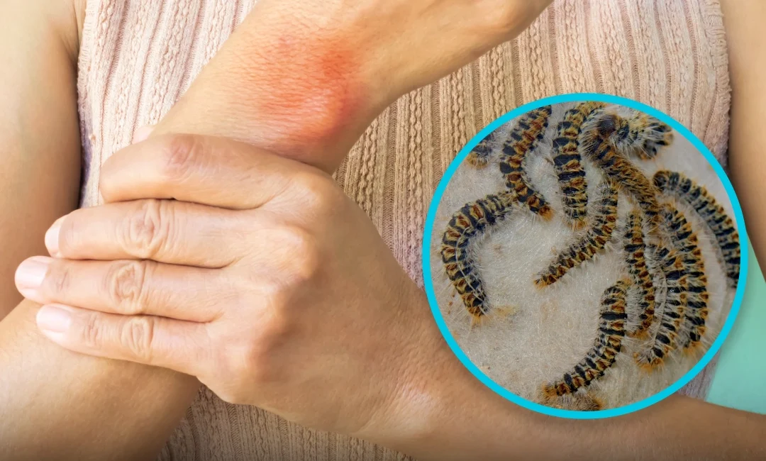 Perigos da lagarta do pinheiro: o que fazer se entrar em contacto